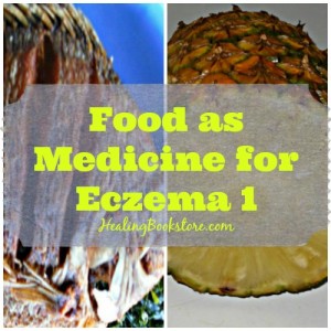 natural eczema treatment