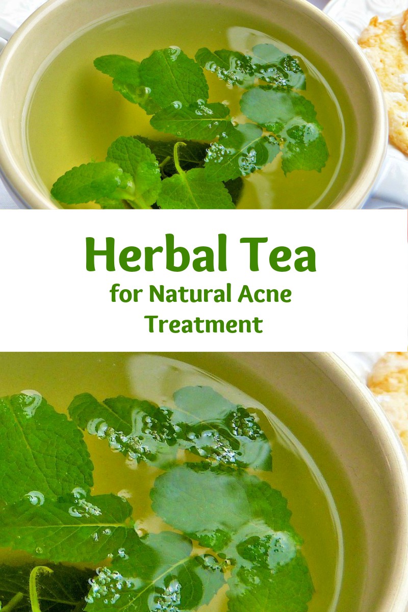 herbal tea for natural acne treatment