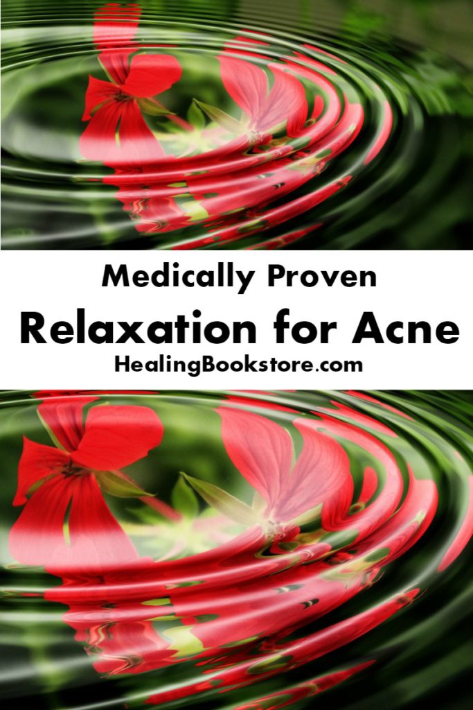 Medically proven relaxation for acne