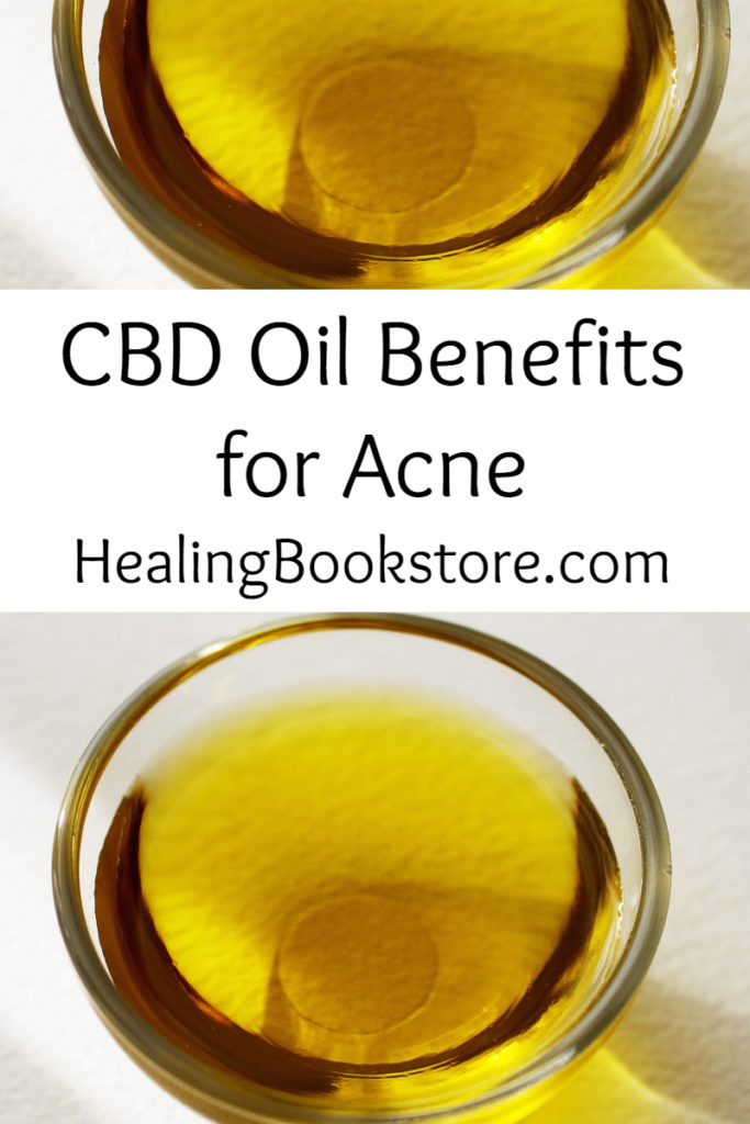 CBD Oil Benefits for Acne