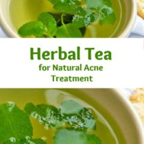 herbal tea for natural acne treatment