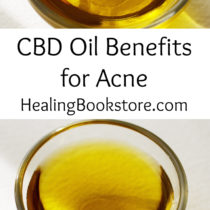 CBD Oil Benefits for Acne